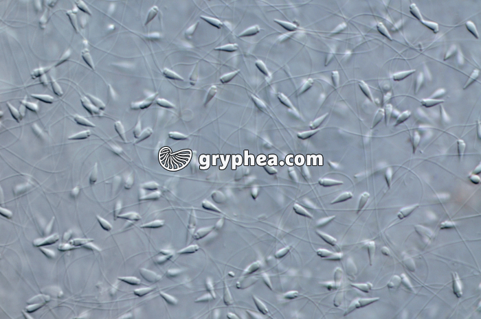 Spermatozoïdes d'Oursin x100 - gryphea.org